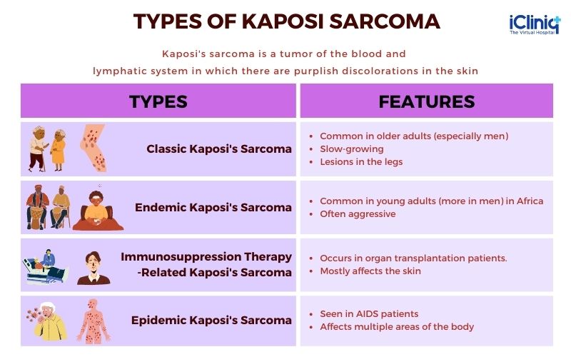 Understanding Kaposis Sarcoma: Causes, Symptoms, and Treatment