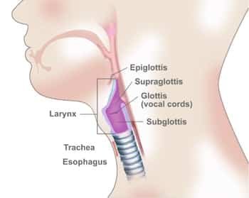 Understanding Larynx Cancer