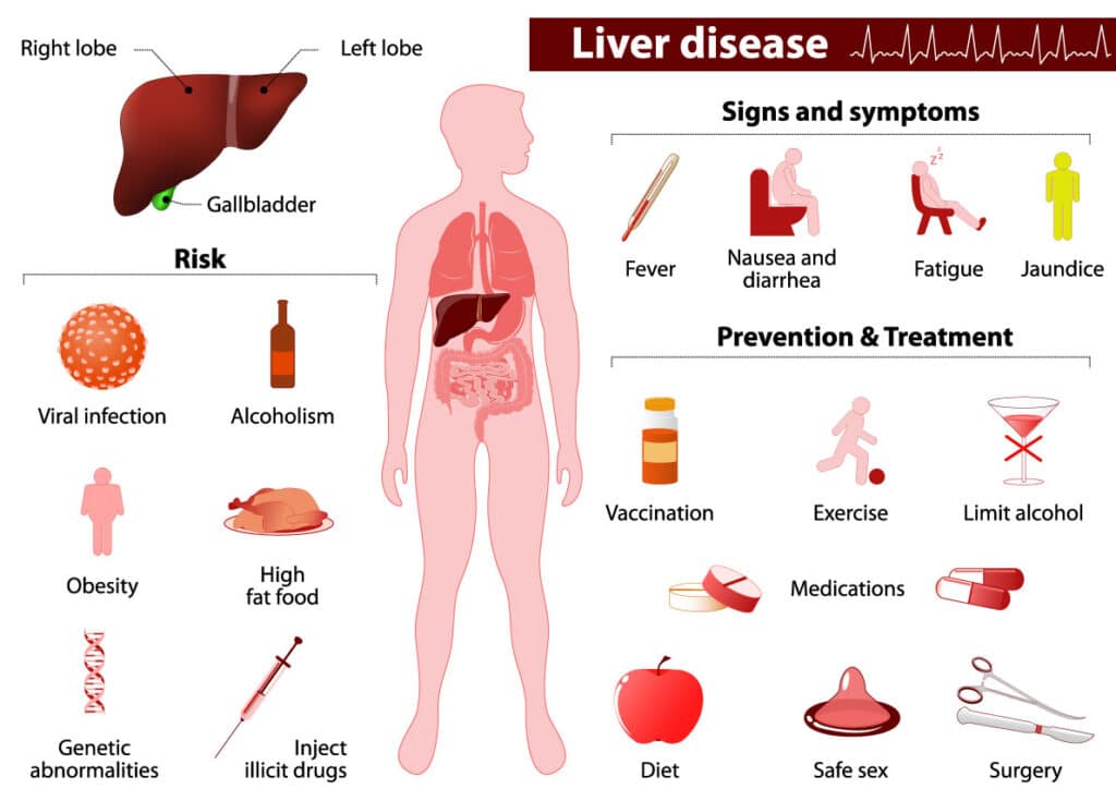 Understanding Liver Failure: Causes, Symptoms, and Treatment Understanding Liver Failure: Causes, Symptoms, and Treatment