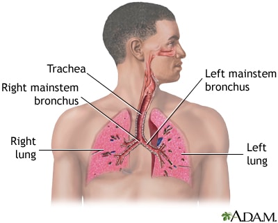 Understanding Lung Disease