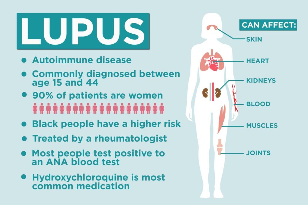 Understanding Lupus: Causes, Symptoms, and Treatment