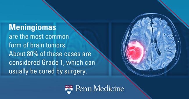Understanding Meningioma Tumors