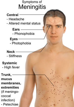 Understanding Meningococcal Disease