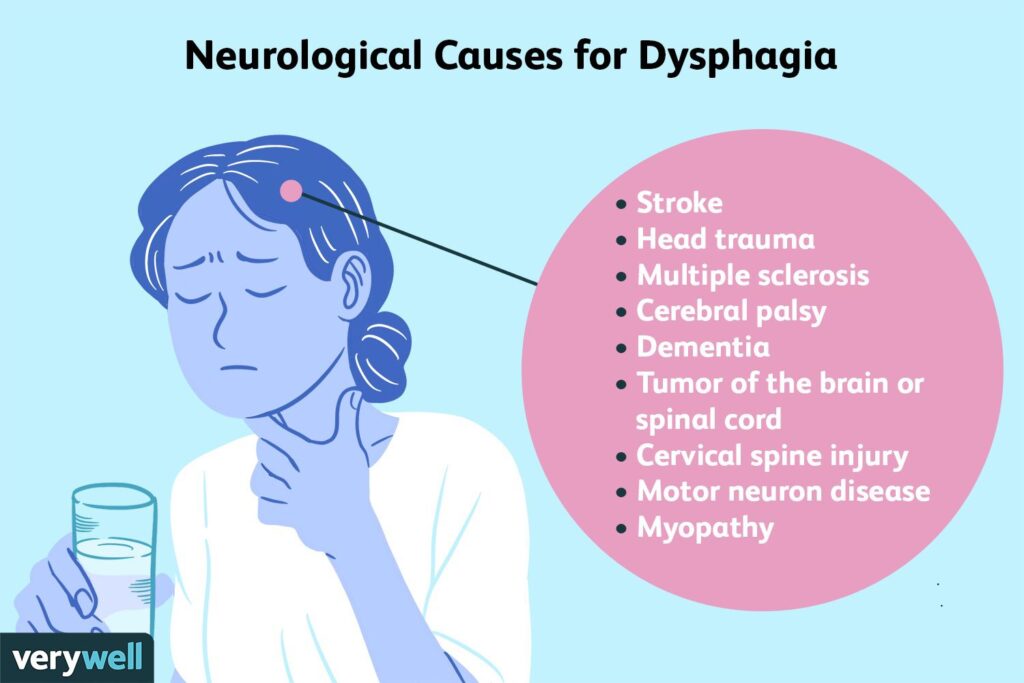 Understanding Swallowing Disorders