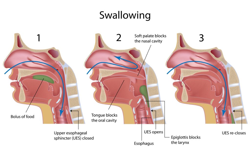 Understanding Swallowing Disorders