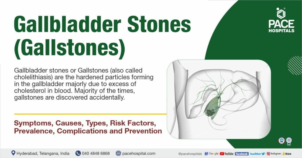 Understanding the Causes of Gallstones