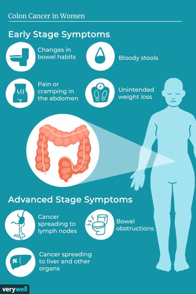 Understanding the Symptoms of Bowel Cancer