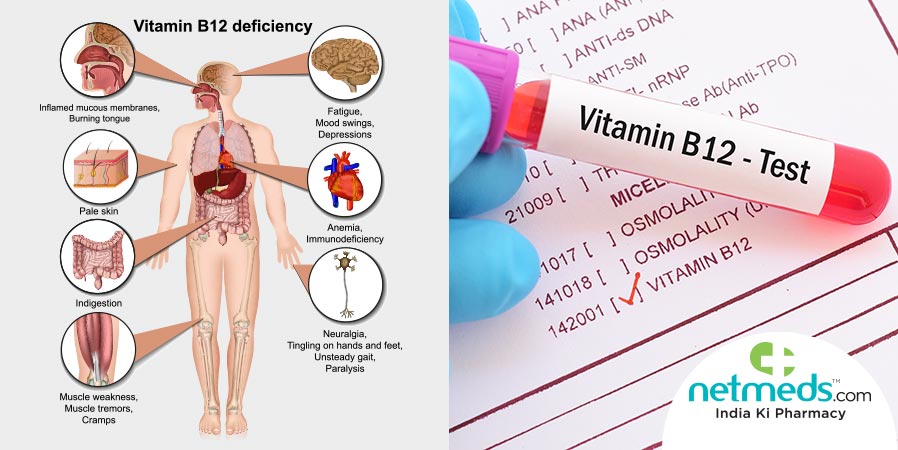 Understanding Vitamin B12 Deficiency Anemia