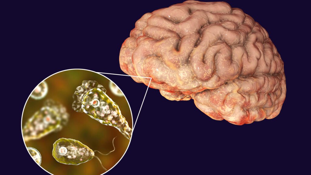 Unraveling the Mystery of Brain-Eating Amoeba