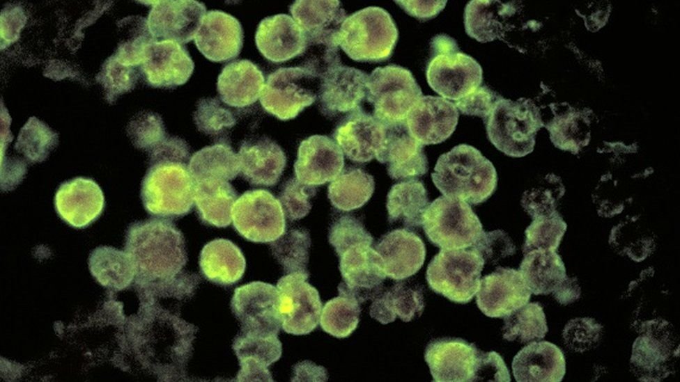Unraveling the Mystery of Brain-Eating Amoeba