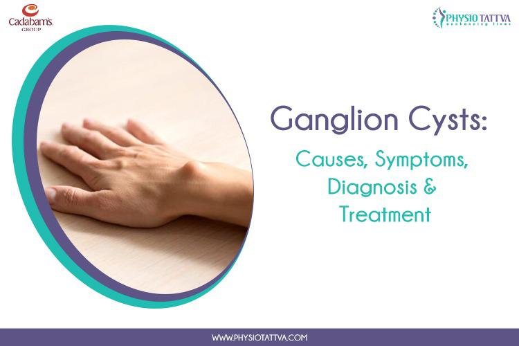 Unveiling Ganglion Cyst Complications: When to Seek Medical Attention