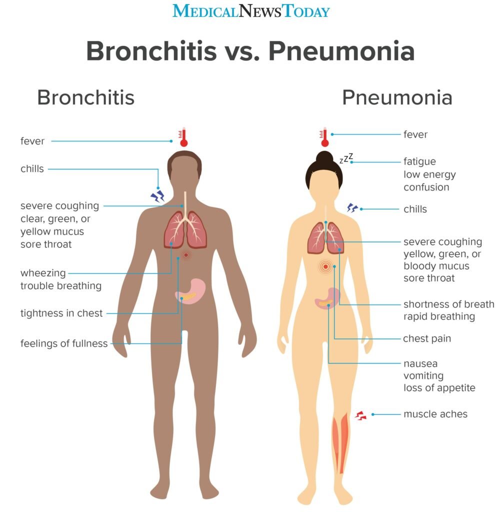 When to Seek Medical Attention for a Chest Infection