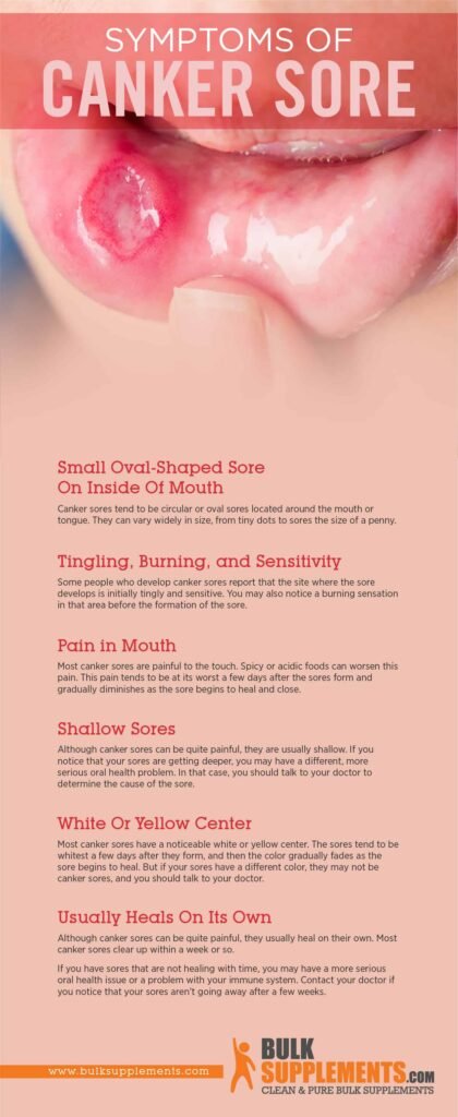 When to Seek Medical Help for Canker Sores