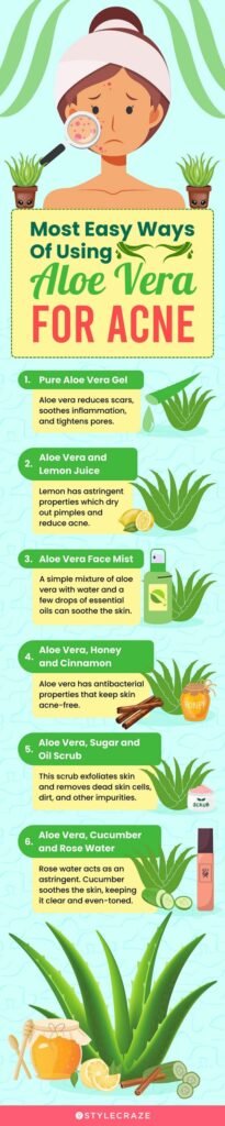 Can Aloe Vera Remove Pimples?