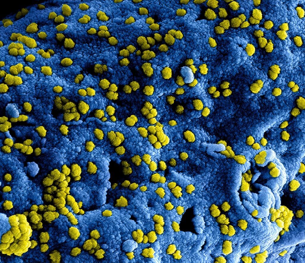 How To Prevent Urinary Tract Infection