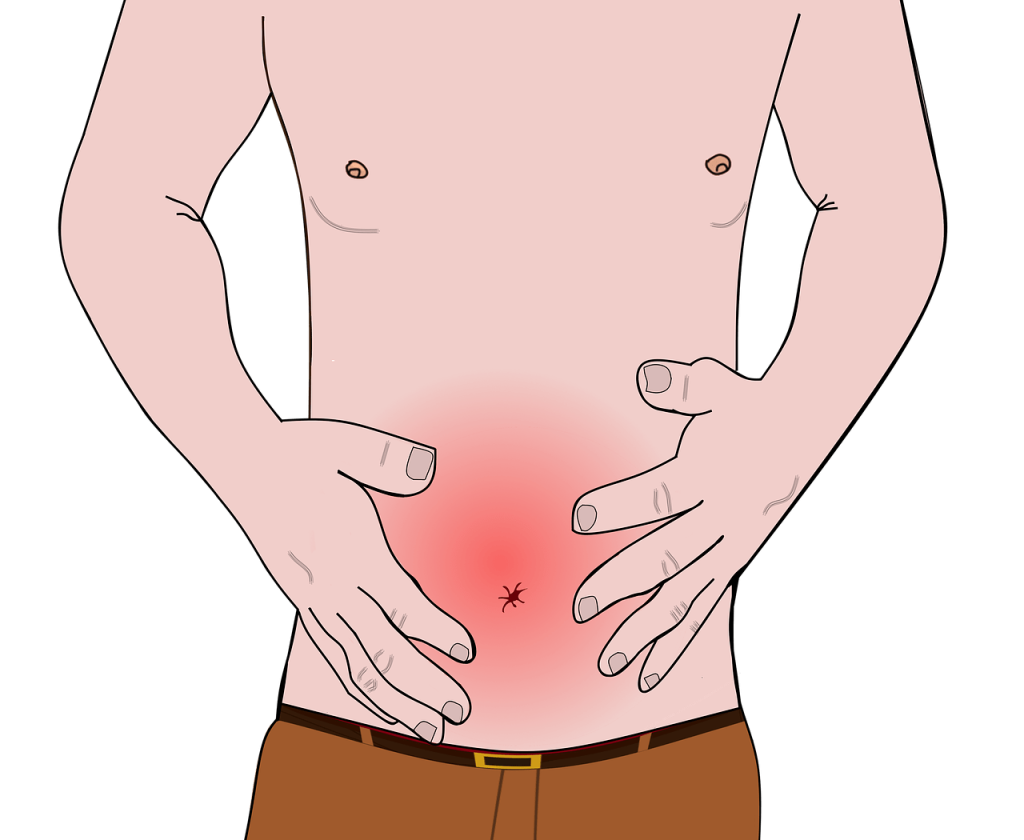 Common Acid Reflux Medications