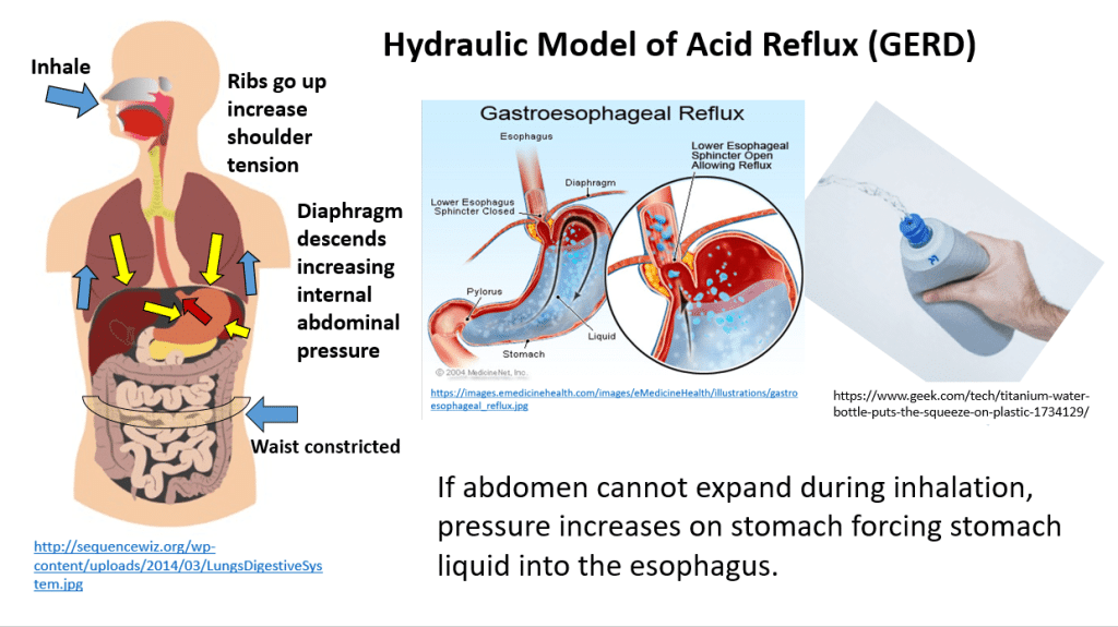 Understanding Acid Reflux: A Common Symptom Before Your Period