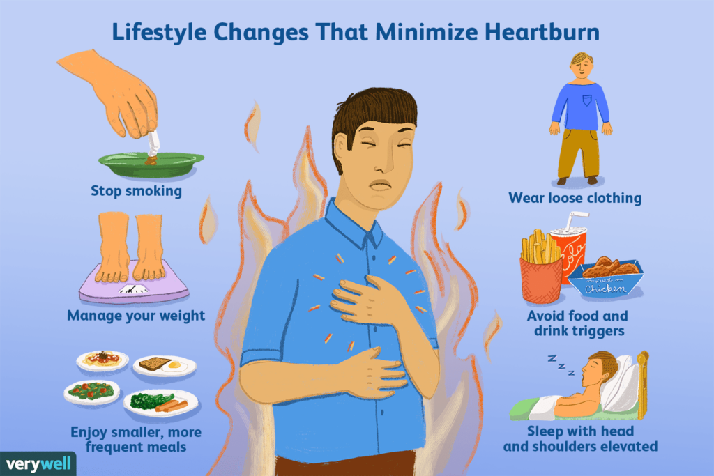 How To Treat Acid Reflux Naturally