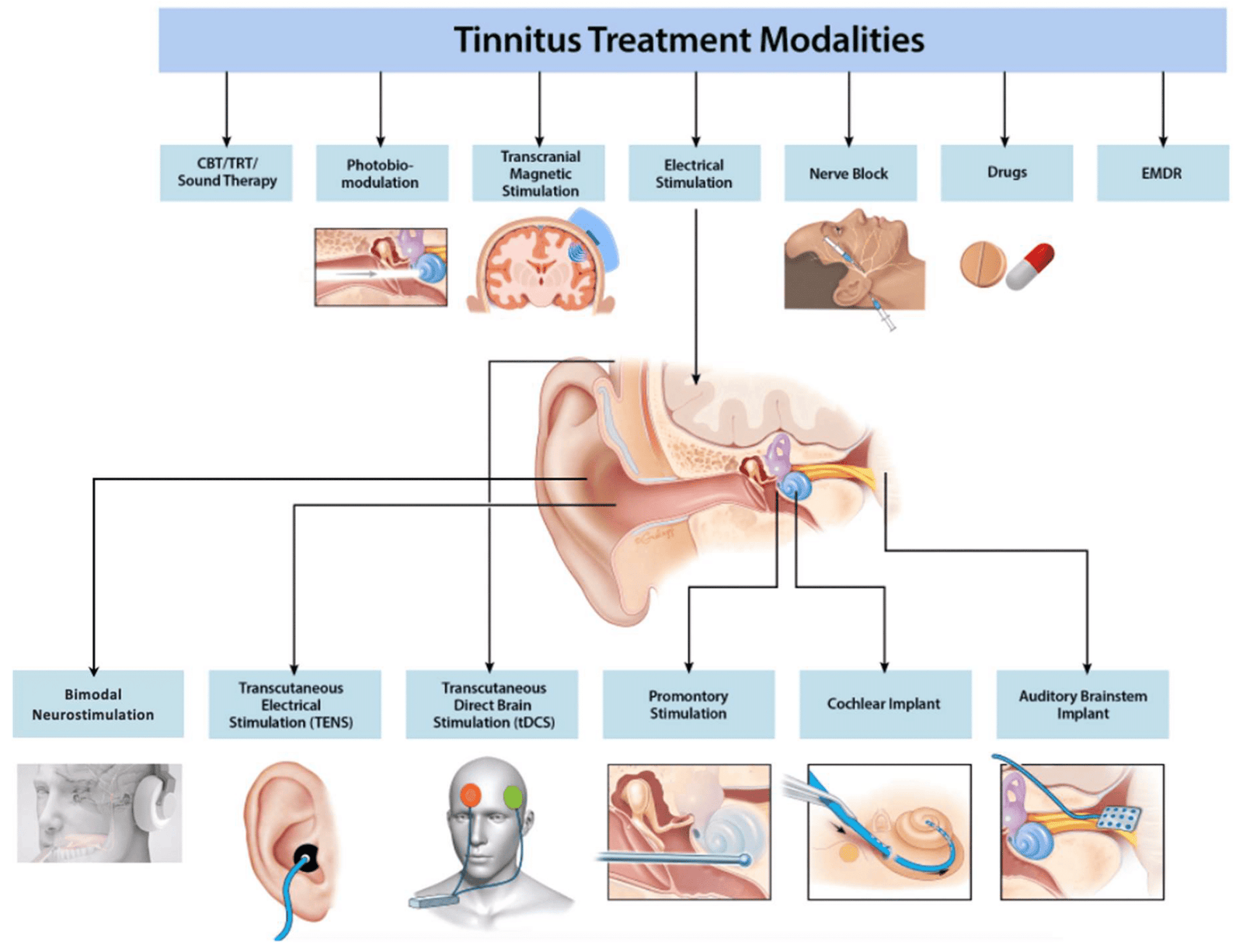 How Do Different Forms Of Tinnitus Treatment, Such As Sound Therapy And Counseling, Work Together For Better Outcomes?