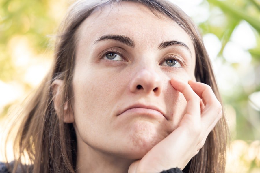 Stress-related Acne