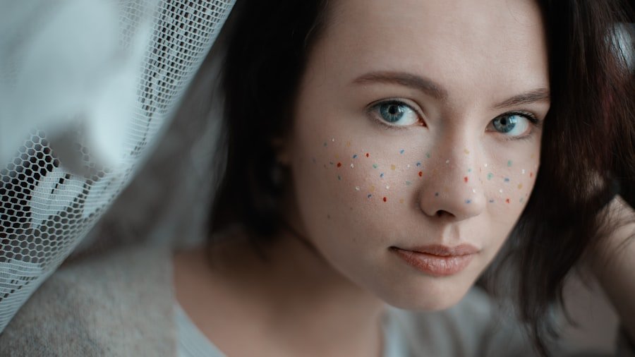 Stress Acne