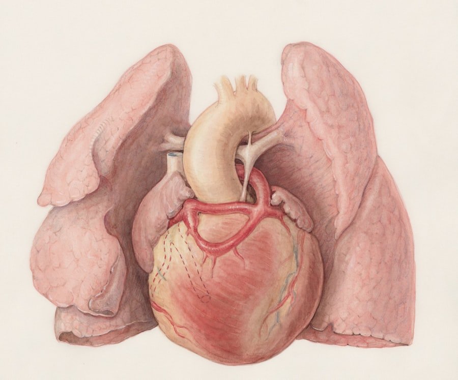 Abdominal Aortic Aneurysms