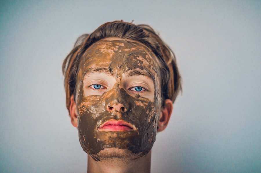 Severe Acne