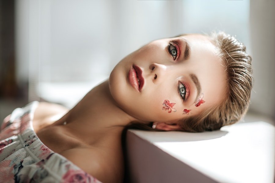Acne Scars