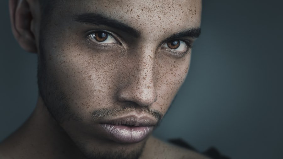 Hyperpigmentation
