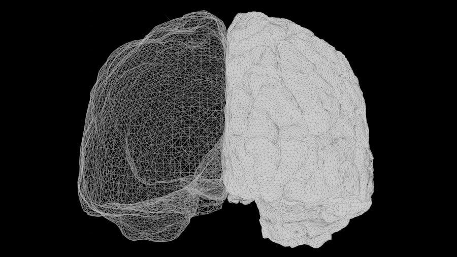 Acoustic Neuroma