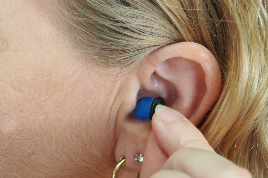 acoustic neuroma, hearing loss