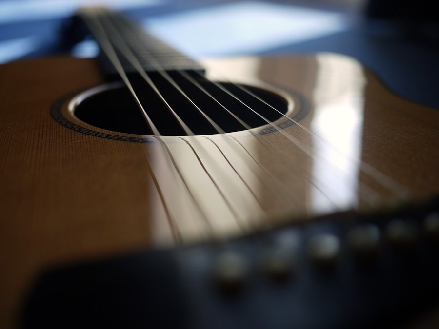 Acoustic Neuroma