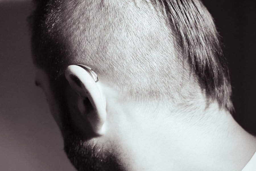 Hearing Loss Acoustic Neuroma