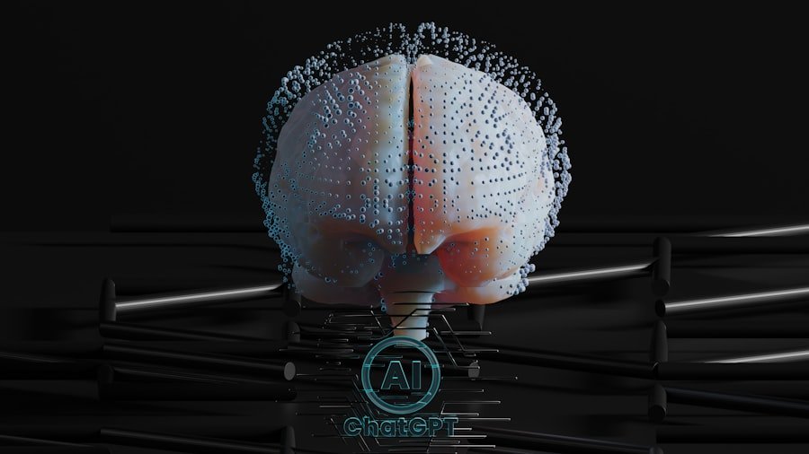 Acoustic Neuroma