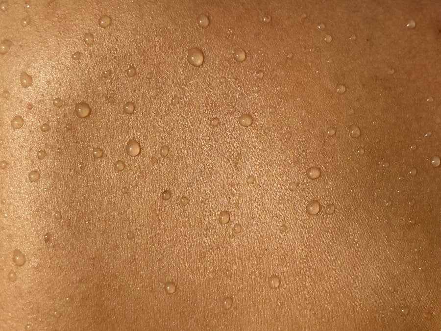 Papules versus Pustules