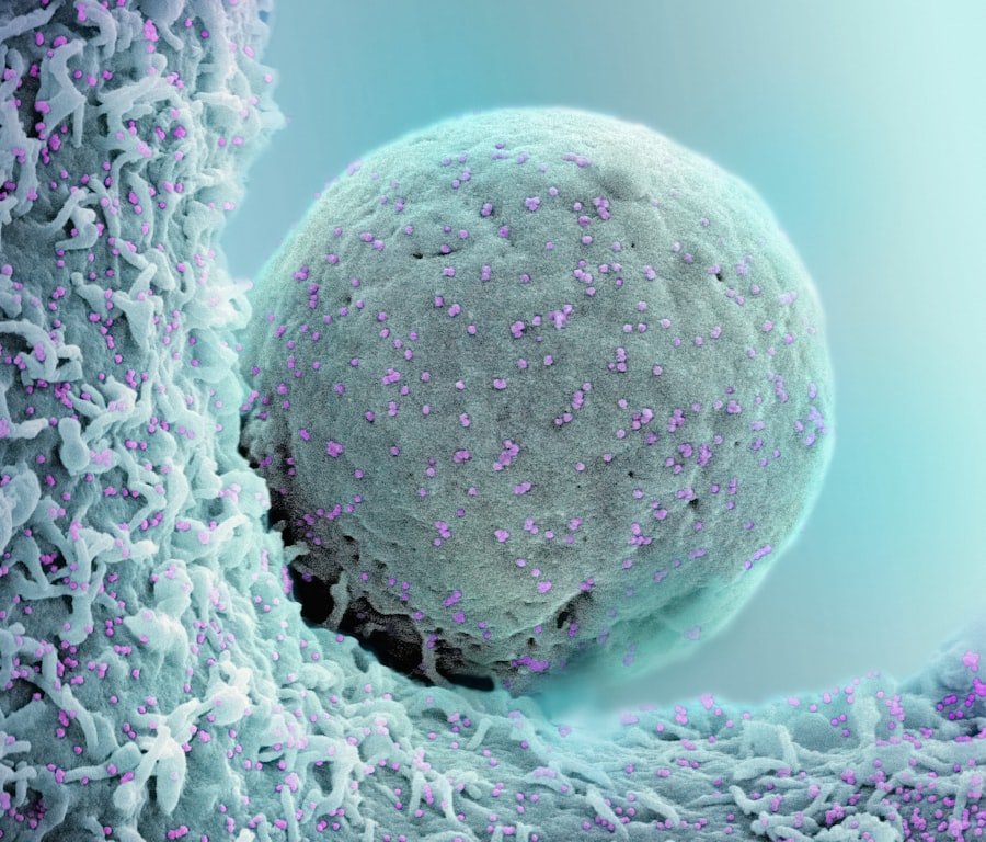 Tumor Recurrence
