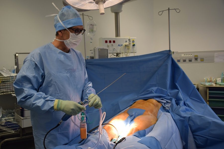Acoustic Neuroma Surgery