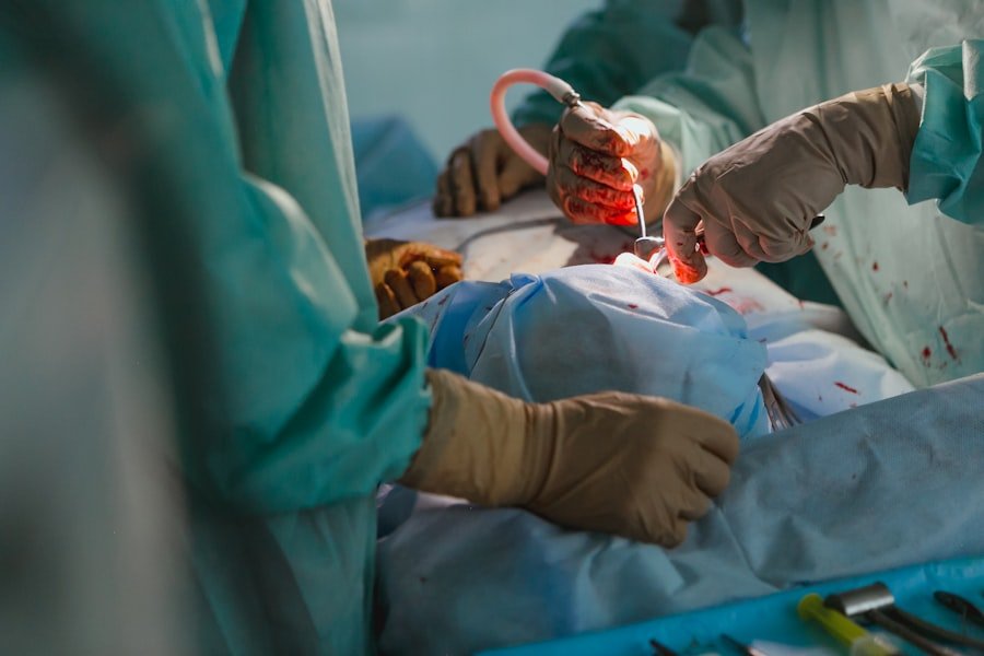 Acoustic Neuroma Surgery