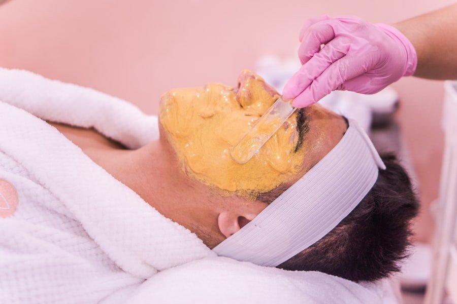 Acne Treatment Options