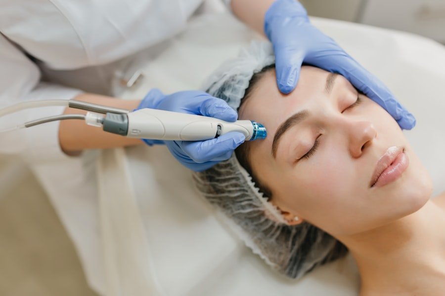 Photo Acne Treatment