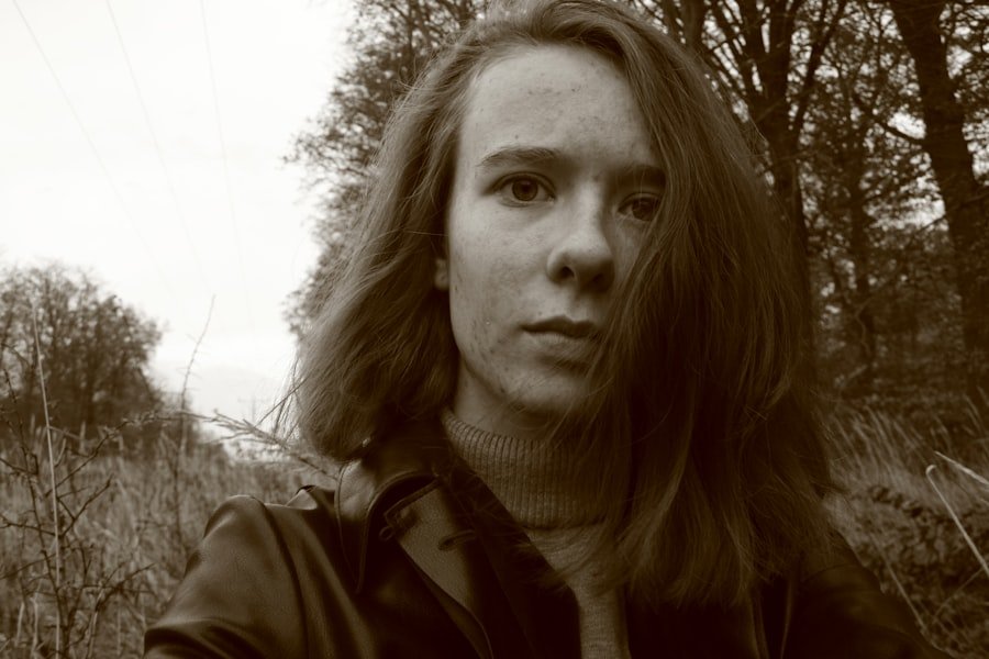 Photo Acne