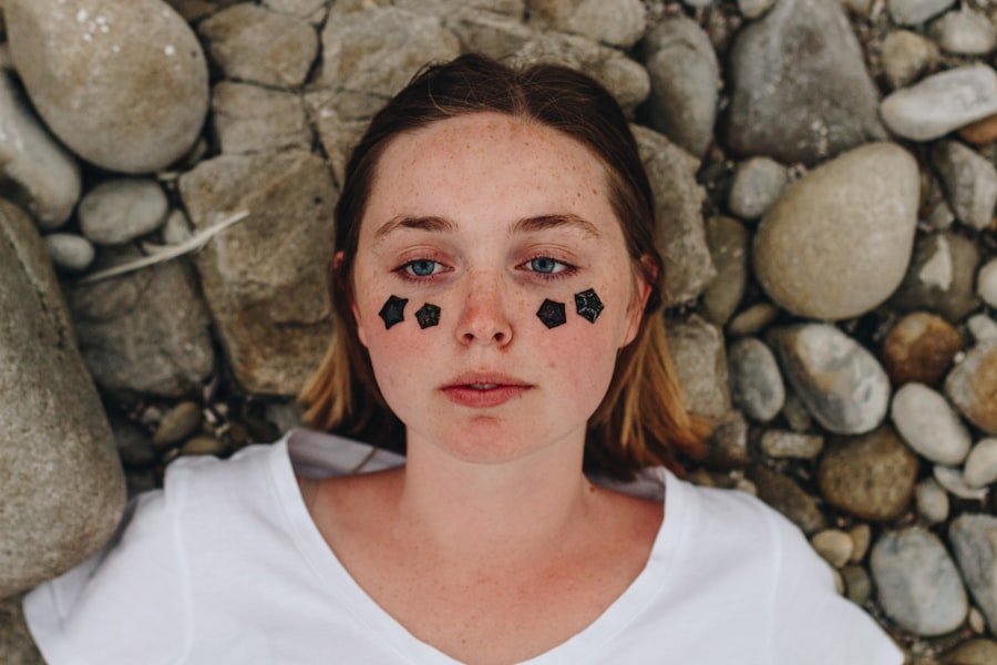 Photo Teen Acne