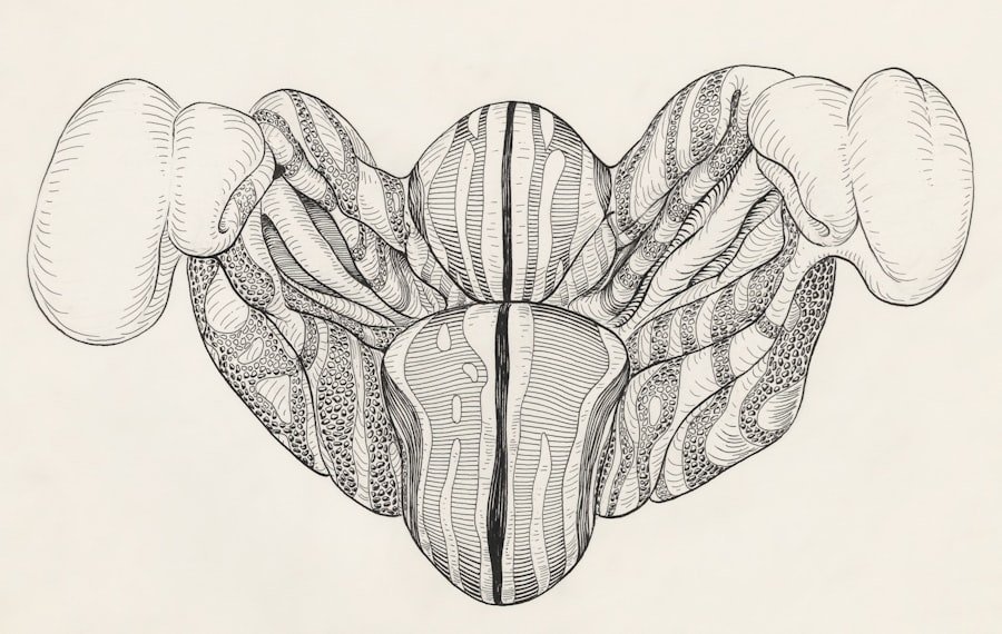 Photo Vestibular Schwannoma