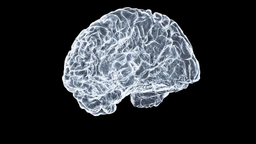 Photo Acoustic Neuroma