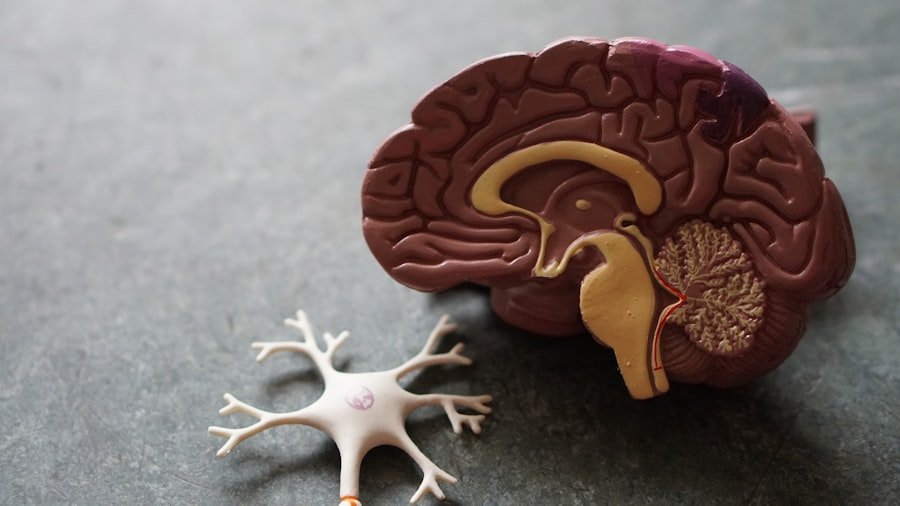 Photo Acoustic Neuroma Symptoms