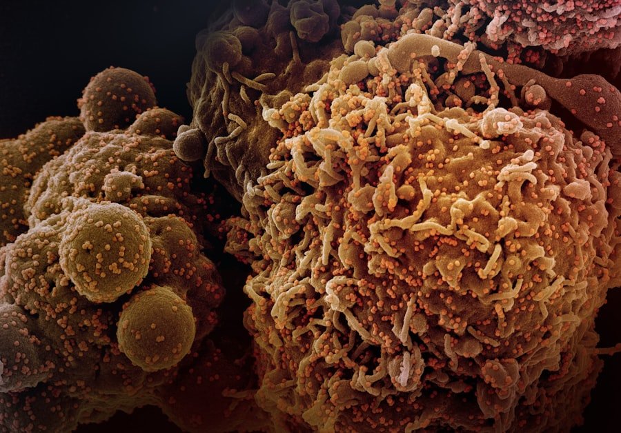 Photo Nf2-related Tumors