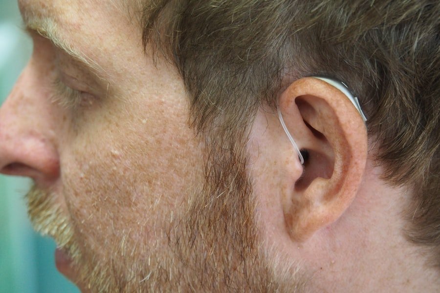 Photo Hearing Loss Acoustic Neuroma