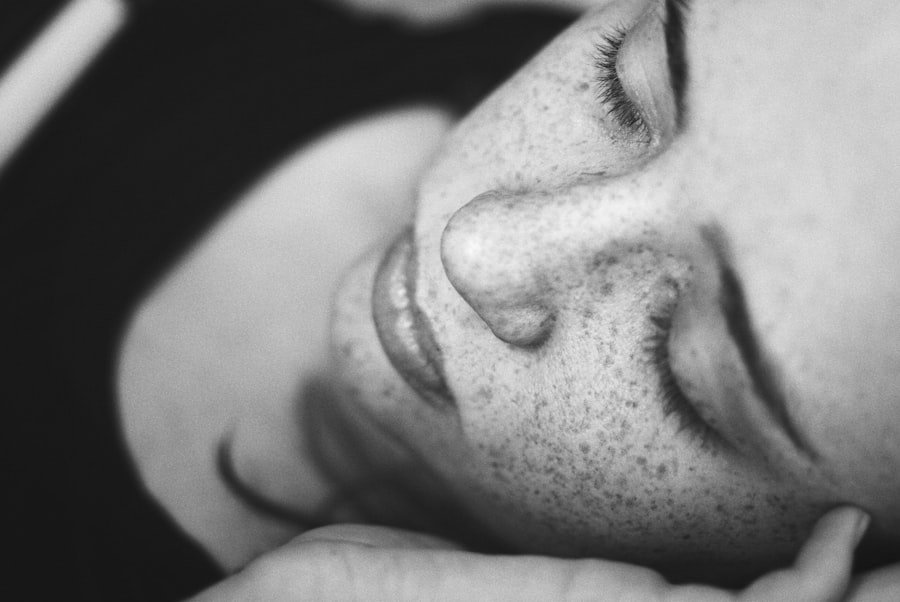 Photo Facial Pain