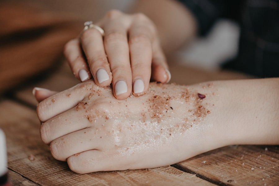 Photo Papules versus Pustules