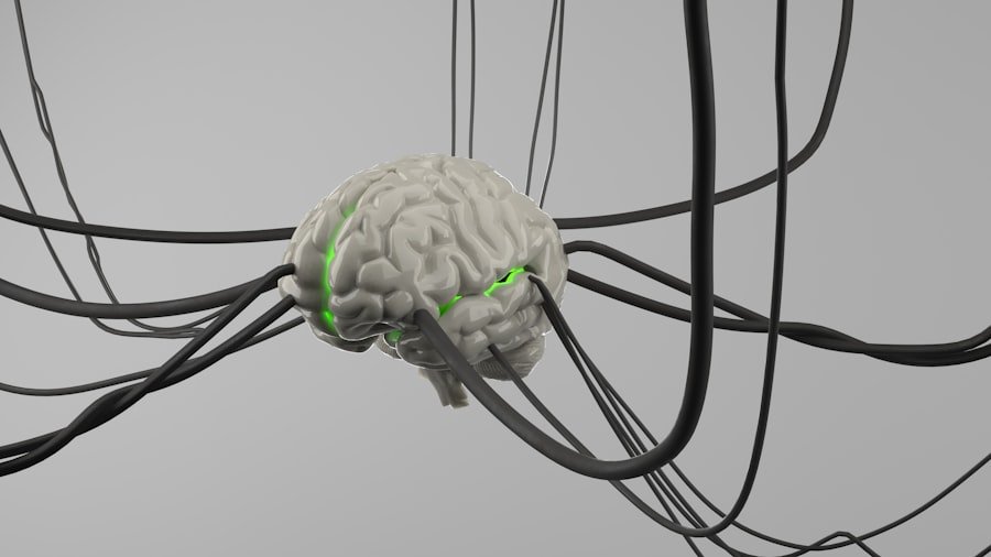 Photo Acoustic Neuroma Patients